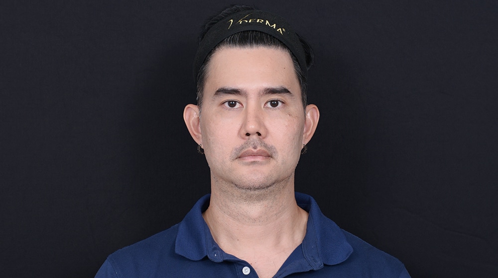 ผลลัพธ์หลังร้อยไหม VDerma 30 วัน เคสที่ 3