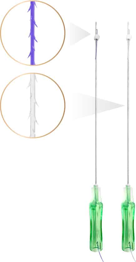 VDerma Thread PDO & P(LA-CL) 360 DEGREE