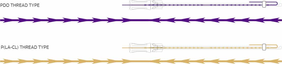 VDERMA Mold Cog Plus Bi-Directional Convergent PDO และ P(LA-CL)