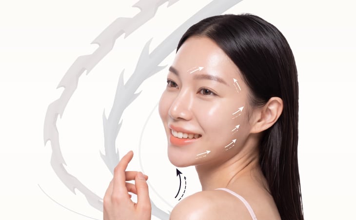 VDerma Thread Lifting Series